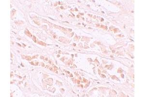 Immunohistochemistry (IHC) image for anti-EF-Hand Calcium Binding Domain 4B (EFCAB4B) (C-Term) antibody (ABIN1030378)