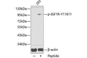 Western blot analysis of extracts from 293 cells, using Phospho-IGF1R-Y1161 antibody (ABIN3020252, ABIN3020253, ABIN3020254 and ABIN1681673).