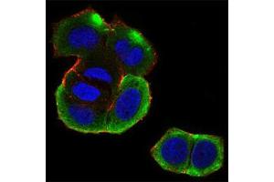 Fig. (CSNK2B Antikörper  (AA 1-215))