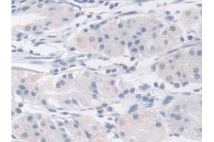Immunohistochemistry (IHC) image for anti-Mannose Phosphate Isomerase (MPI) (AA 2-423) antibody (ABIN7441487)