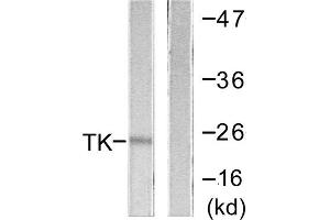 Western blot analysis of extracts from COLO205 cells, using TK (epitope around residue 13) antibody. (TK (N-Term), (Ser13) Antikörper)