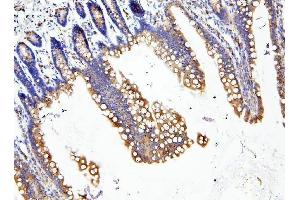 IHC analysis of LOR using anti-LOR antibody (ABIN6719582). (LOR Antikörper  (AA 1-312))