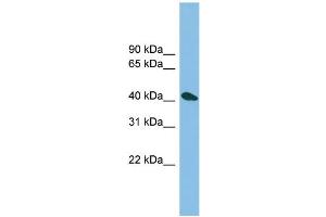 WB Suggested Anti-ZNF514 Antibody Titration: 0. (ZNF514 Antikörper  (N-Term))