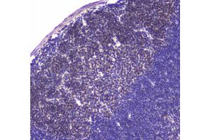 Immunohistochemistry (IHC) image for anti-Ubiquitin Specific Peptidase 7 (Herpes Virus-Associated) (USP7) (AA 258-483) antibody (ABIN5693267)
