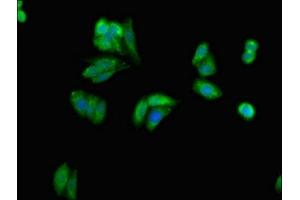 Immunofluorescent analysis of HepG2 cells using ABIN7154494 at dilution of 1:100 and Alexa Fluor 488-congugated AffiniPure Goat Anti-Rabbit IgG(H+L) (PIK3R1 Antikörper  (AA 15-180))