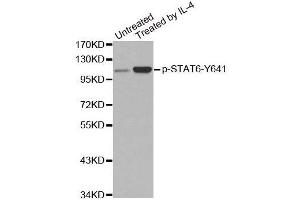 Western blot analysis of extracts from Hela cells,using Phospho-STAT6-Y641 antibody. (STAT6 Antikörper  (pTyr641))