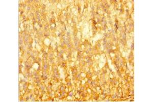 Immunohistochemistry of paraffin-embedded human adrenal gland tissue using ABIN7145808 at dilution of 1:100 (BRD3 Antikörper  (AA 356-506))