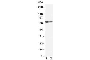 Western Blotting (WB) image for anti-ATP-Binding Cassette, Sub-Family D (Ald), Member 3 (ABCD3) (C-Term) antibody (ABIN3030056)