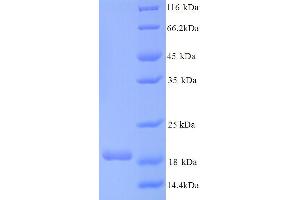 SDS-PAGE (SDS) image for Connector Enhancer of Kinase Suppressor of Ras 2 (CNKSR2) (AA 650-800) protein (His tag) (ABIN5713368) (CNKSR2 Protein (AA 650-800) (His tag))