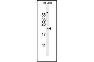 Western blot analysis of PLA2G2C Antibody (C-term) in HL-60 cell line lysates (35ug/lane). (PLA2G2C Antikörper  (C-Term))