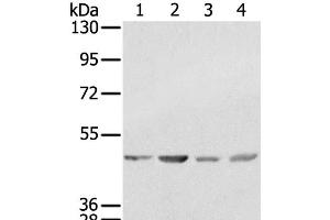 Western Blot analysis of K562, 231, Raji and hela cell using SSB Polyclonal Antibody at dilution of 1:400 (SSB Antikörper)