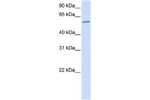 PPP3CA antibody used at 1 ug/ml to detect target protein. (PPP3CA Antikörper)