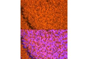 Immunofluorescence analysis of mouse brain using NgR3 Rabbit mAb (ABIN7269932) at dilution of 1:50 (40x lens). (RTN4RL1 Antikörper)