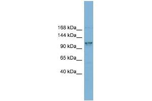 WB Suggested Anti-CCDC87 Antibody Titration: 0. (CCDC87 Antikörper  (N-Term))
