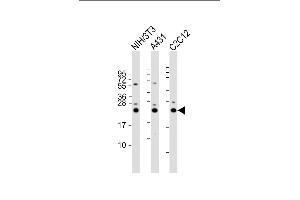 All lanes : Anti-RAB7 Antibody (C-term) at 1:2000 dilution Lane 1: NIH/3T3 whole cell lysate Lane 2: A431 whole cell lysate Lane 3: C2C12 whole cell lysate Lysates/proteins at 20 μg per lane.