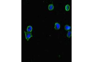 Immunofluorescent analysis of MCF-7 cells using ABIN7147459 at dilution of 1:100 and Alexa Fluor 488-congugated AffiniPure Goat Anti-Rabbit IgG(H+L) (CERKL Antikörper  (AA 1-558))
