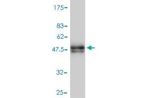 Western Blot detection against Immunogen (47. (MYL4 Antikörper  (AA 1-197))