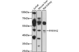 Western blot analysis of extracts of various cell lines, using P antibody (ABIN7269402) at 1:1000 dilution. (PAFAH2 Antikörper  (AA 260-350))