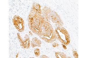 Immunohistochemistry (IHC) image for anti-Dipeptidyl-Peptidase 4 (DPP4) (AA 29-766) antibody (ABIN7795690)