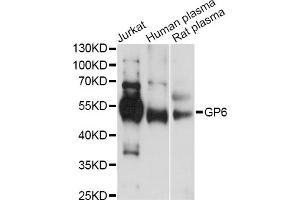 Western blot analysis of extracts of various cell lines, using GP6 antibody (ABIN6293681) at 1:1000 dilution. (GP6 Antikörper)
