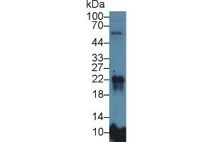 Western Blot; Sample: Rat Lung lysate; Primary Ab: 5µg/ml Rabbit Anti-Rat MFAP5 Antibody Second Ab: 0. (MFAP5 Antikörper  (AA 32-164))