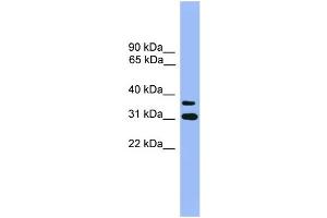 WB Suggested Anti-OR2D3 Antibody Titration: 1.