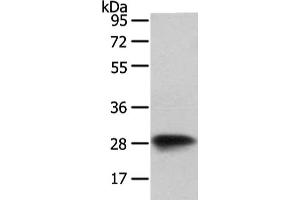 Gel: 8 % SDS-PAGE, Lysate: 40 μg, Lane: NIH/3T3 cell, Primary antibody: ABIN7128073(VAPA Antibody) at dilution 1/400 dilution, Secondary antibody: Goat anti rabbit IgG at 1/8000 dilution, Exposure time: 1 second (VAPA Antikörper)