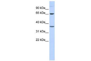 Epsin 2 antibody used at 1 ug/ml to detect target protein. (Epsin 2 Antikörper  (Middle Region))