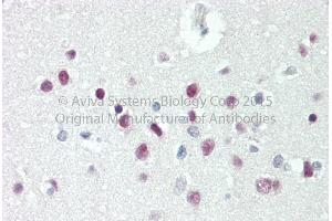 Rabbit Anti-TBX15 antibody   Formalin Fixed Paraffin Embedded Tissue: Human Adult Brain, cortex  Observed Staining: Cytoplasm in hepatocytes Primary Antibody Concentration: 1:600 Secondary Antibody: Donkey anti-Rabbit-Cy3 Secondary Antibody Concentration: 1:200 Magnification: 20X Exposure Time: 0. (T-Box 15 Antikörper  (C-Term))
