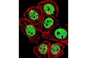 Fluorescent confocal image of A549 cell stained with FOXG1 Antibody (Center) (ABIN653750 and ABIN2843050). (FOXG1 Antikörper  (AA 225-252))