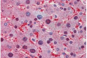 Immunohistochemistry (Formalin-fixed Paraffin-embedded Sections) (IHC (fp)) image for anti-Lactate Dehydrogenase A (LDHA) (N-Term) antibody (ABIN6747164)