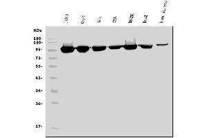 Western blot analysis of EEF2/Elongation factor 2 using anti-EEF2/Elongation factor 2 antibody (ABIN7603142).