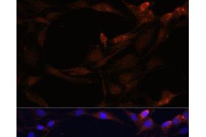 Immunofluorescence (IF) image for anti-serpin Peptidase Inhibitor, Clade B (Ovalbumin), Member 9 (SERPINB9) antibody (ABIN7262204)