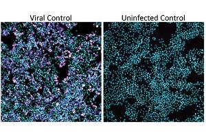 Biosafety Level 3 (BSL-3) SARS-CoV-2 bioassay in H1437 cells with washout step and raw infectivity of H1437 cells by SARS-CoV-2 WA1 strain. (SARS-CoV-2 Nucleocapsid Antikörper)