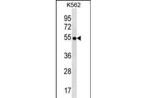LAX1 Antibody (C-term) (ABIN1537207 and ABIN2850101) western blot analysis in K562 cell line lysates (35 μg/lane). (LAX1 Antikörper  (C-Term))