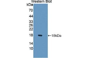 Western blot analysis of the recombinant protein. (CXCL9 Antikörper  (AA 22-125))