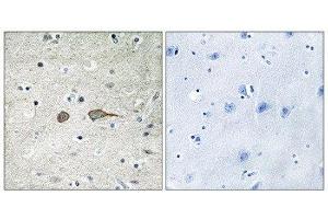 Immunohistochemistry (IHC) image for anti-MAP-Kinase Activating Death Domain (MADD) (Internal Region) antibody (ABIN1849836) (MADD Antikörper  (Internal Region))