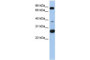 WB Suggested Anti-C1orf110 Antibody Titration: 0. (C1ORF110 Antikörper  (N-Term))