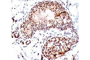 IHC staining of human tonsil with SUMO1 antibody (SM1/495). (SUMO1 Antikörper)