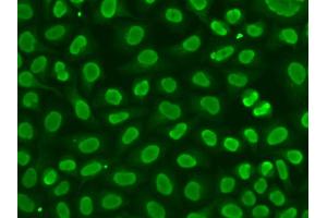 Immunofluorescence analysis of HeLa cells using FEN1 antibody. (FEN1 Antikörper)