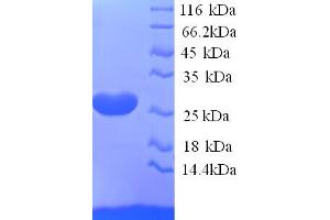 SDS-PAGE (SDS) image for Ephrin A5 (EFNA5) (AA 21-203) protein (His tag) (ABIN5713414) (Ephrin A5 Protein (EFNA5) (AA 21-203) (His tag))