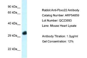 Western Blotting (WB) image for anti-F-Box Protein 22 (FBXO22) (Middle Region) antibody (ABIN2785926) (FBXO22 Antikörper  (Middle Region))