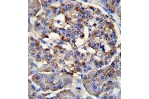 Immunohistochemistry analysis in formalin fixed and paraffin embedded human pancreas tissue reacted with LRRC68 Antibody (N-term) followed which was followed peroxidase conjugated to the secondary antibody followed by DAB staining. (PPP1R37 Antikörper  (N-Term))