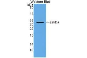 Detection of Recombinant TTN, Human using Monoclonal Antibody to Titin (TTN) (Titin Antikörper  (AA 33779-34025))