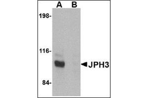 Western blot analysis of JPH3 in Daudi cell lysate with this product at 1 μg/ml in (A) the absence and (B) the presence of blocking peptide. (Junctophilin 3 Antikörper  (C-Term))