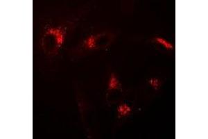 Immunofluorescent analysis of USP10 staining in A549 cells. (USP10 Antikörper)