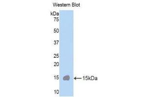 Western Blotting (WB) image for anti-Cubilin (Intrinsic Factor-Cobalamin Receptor) (CUBN) (AA 3511-3623) antibody (ABIN1858563)