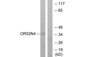 Western blot analysis of extracts from HeLa cells, using OR52N4 antibody. (OR52N4 Antikörper  (C-Term))