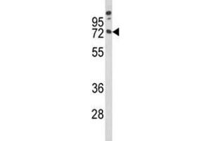 Western blot analysis of MAG antibody and A375 lysate (MAG Antikörper  (AA 439-466))