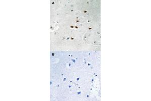 Immunohistochemical staining of human brain tissue by ITCH (phospho Y420) polyclonal antibody  without blocking peptide (A) or preincubated with blocking peptide (B) under 1:50-1:100 dilution. (ITCH Antikörper  (pTyr420))